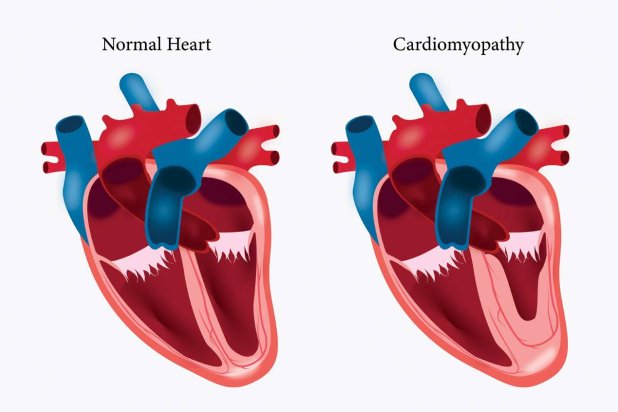 أمراض القلب والأوعية الدموية للصغار والكبار